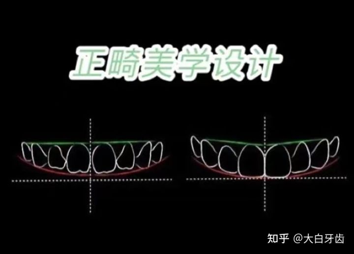 2022年成都十大牙齒矯正醫(yī)院排名,成都牙齒矯正哪里性?xún)r(jià)比最高?成都牙齒矯正價(jià)格表!(圖5) 2022年成都十大牙齒矯正醫(yī)院排名,成都牙齒矯正哪里性?xún)r(jià)比最高?成都牙齒矯正價(jià)格表!(圖5)