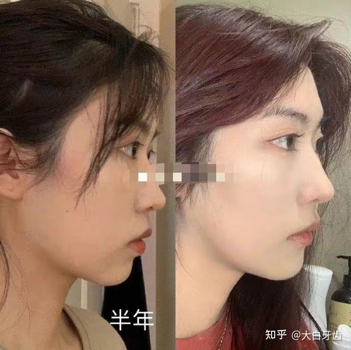 2022年成都十大牙齒矯正醫(yī)院排名,成都牙齒矯正哪里性?xún)r(jià)比最高?成都牙齒矯正價(jià)格表!(圖9) 2022年成都十大牙齒矯正醫(yī)院排名,成都牙齒矯正哪里性?xún)r(jià)比最高?成都牙齒矯正價(jià)格表!(圖9)