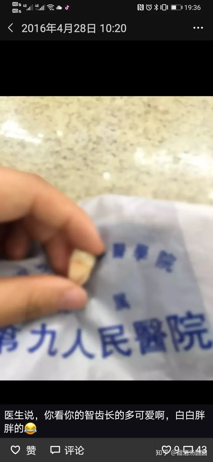 我在長沙市口腔醫院補牙全過程及經驗分享(圖5)